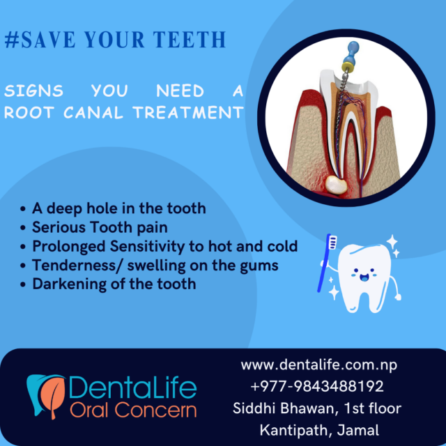 Root Canal Treatment {RCT)