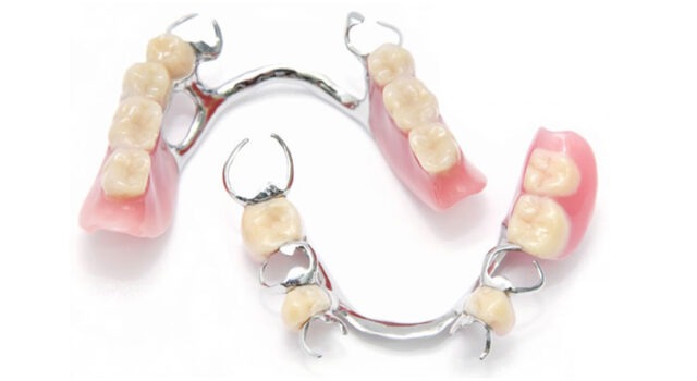 Cast Partial Denture CPD