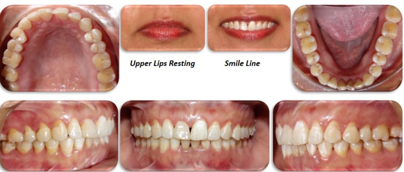 After Treatment After Treatment